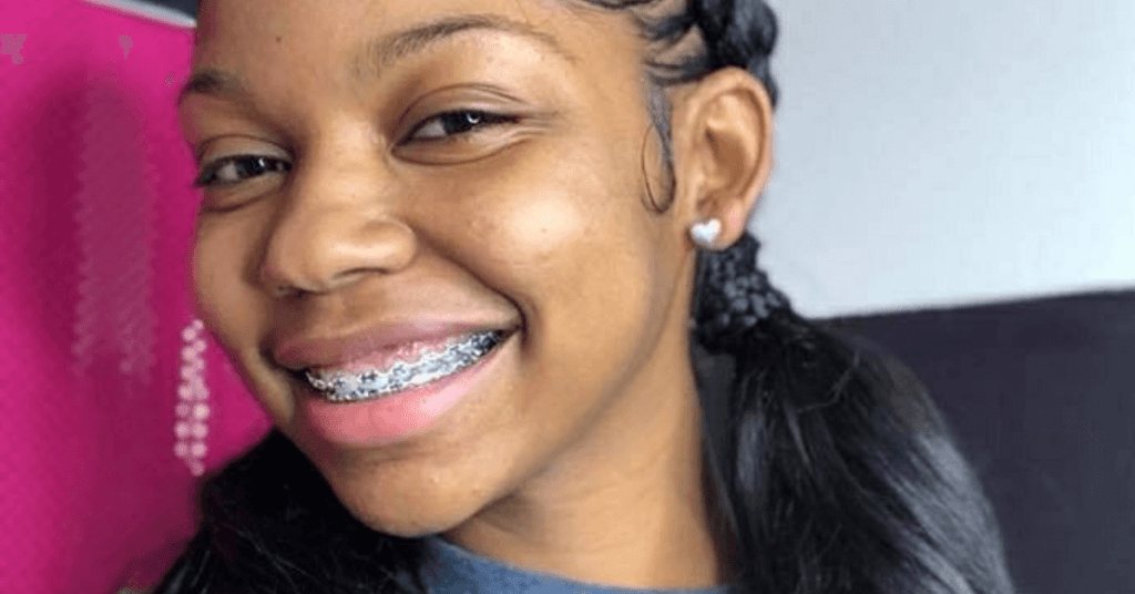 Dental Braces Specification & Price In Nigeria